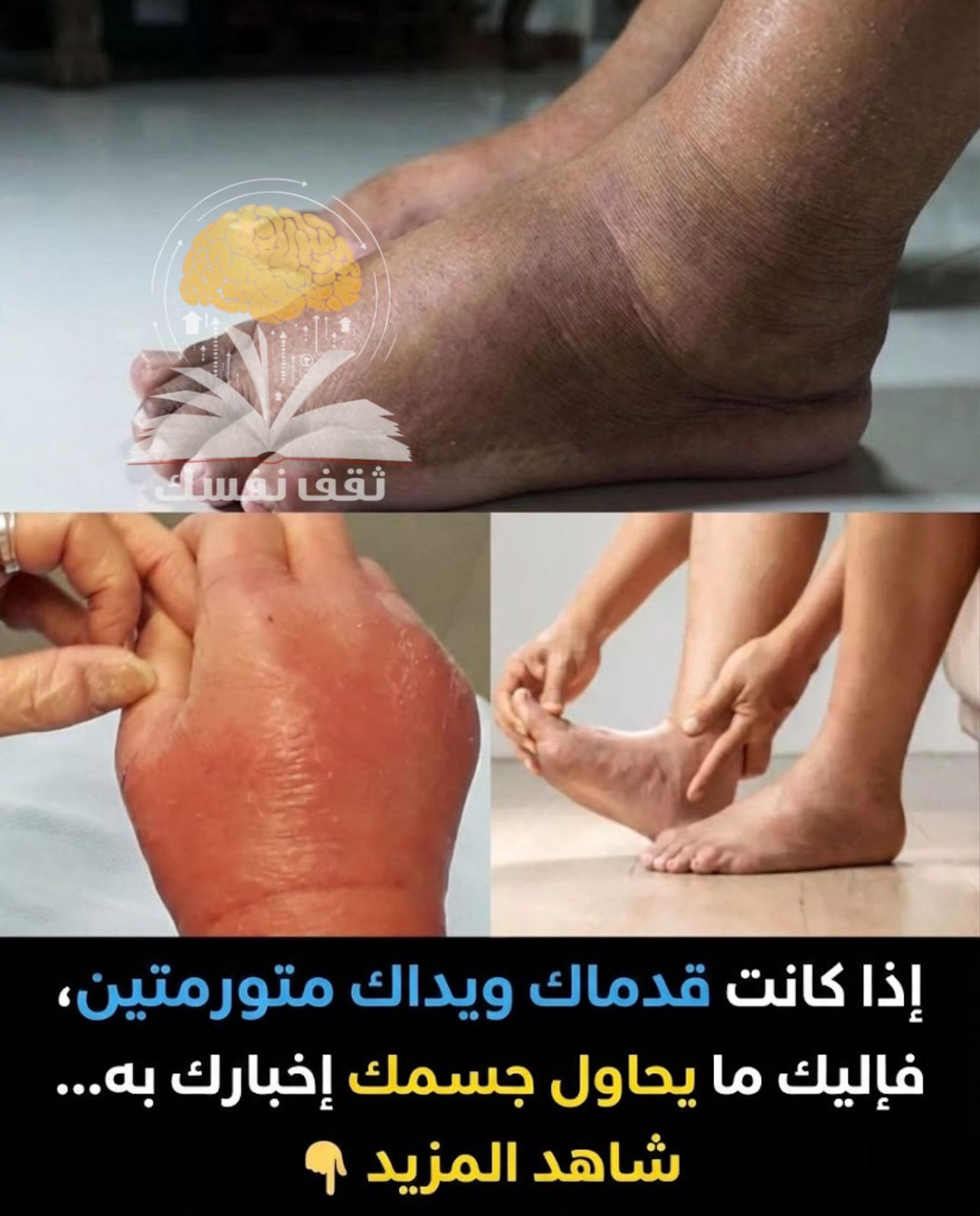تورم القدمين واليدين على ماذا يدل