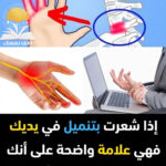 تنميل اليدين أثناء النوم