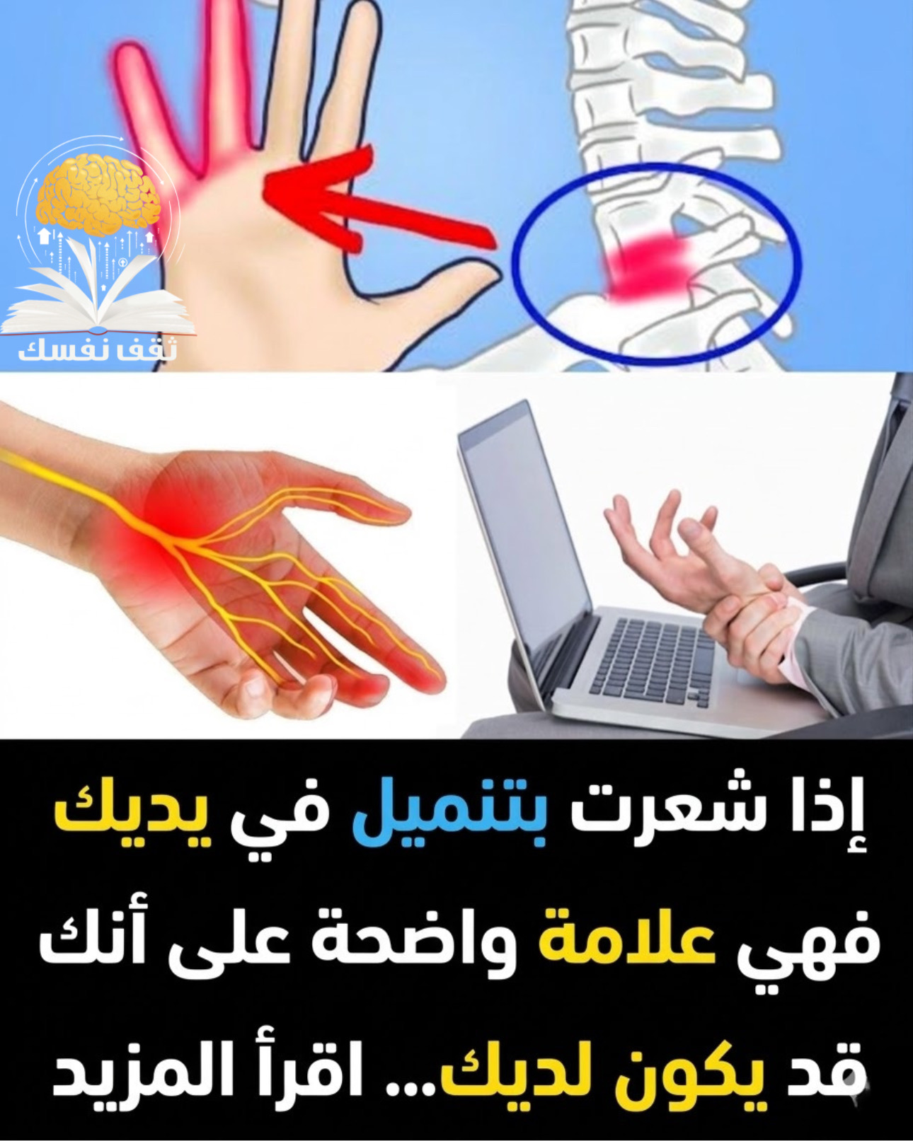 تنميل اليدين أثناء النوم