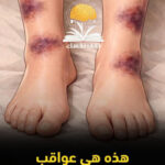 تجنب النوم مع الهاتف واحذر