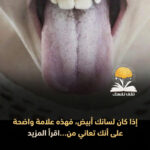اللسان الأبيض ماذا يخبرنا ؟ بين الصحة والمرض