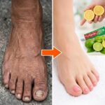 كيف حسّنت مظهر ساقيَّ وجعلتها أكثر بياض ؟ تبييض الساق