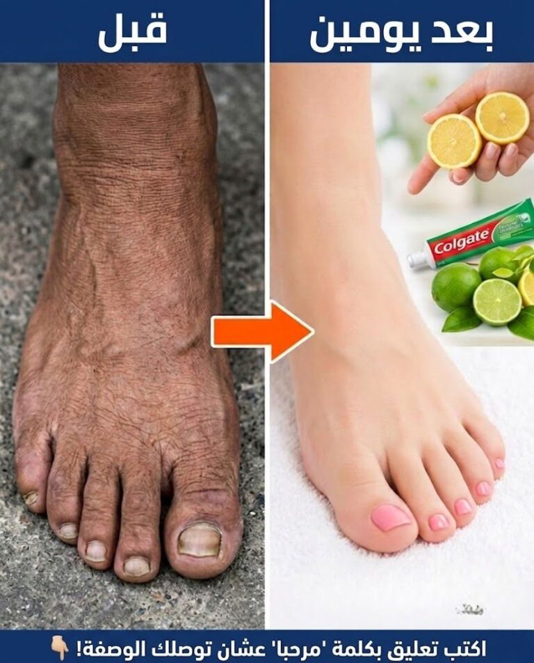 كيف حسّنت مظهر ساقيَّ وجعلتها أكثر بياض ؟ تبييض الساق