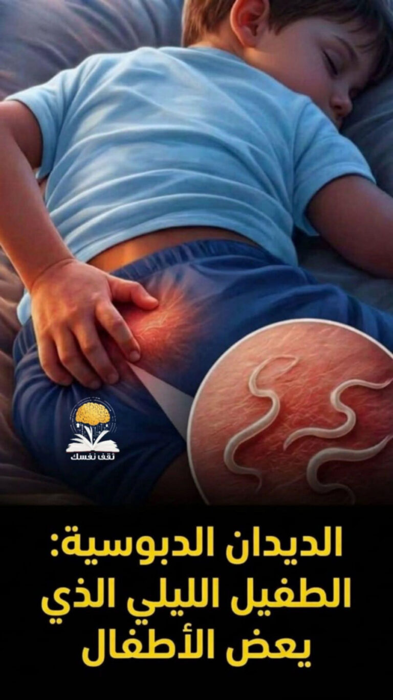 الدود عند الأطفال