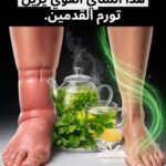 شاي قوي يزيل تورم القدمين