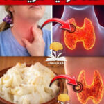 طعام يدمر الغدة الدرقية