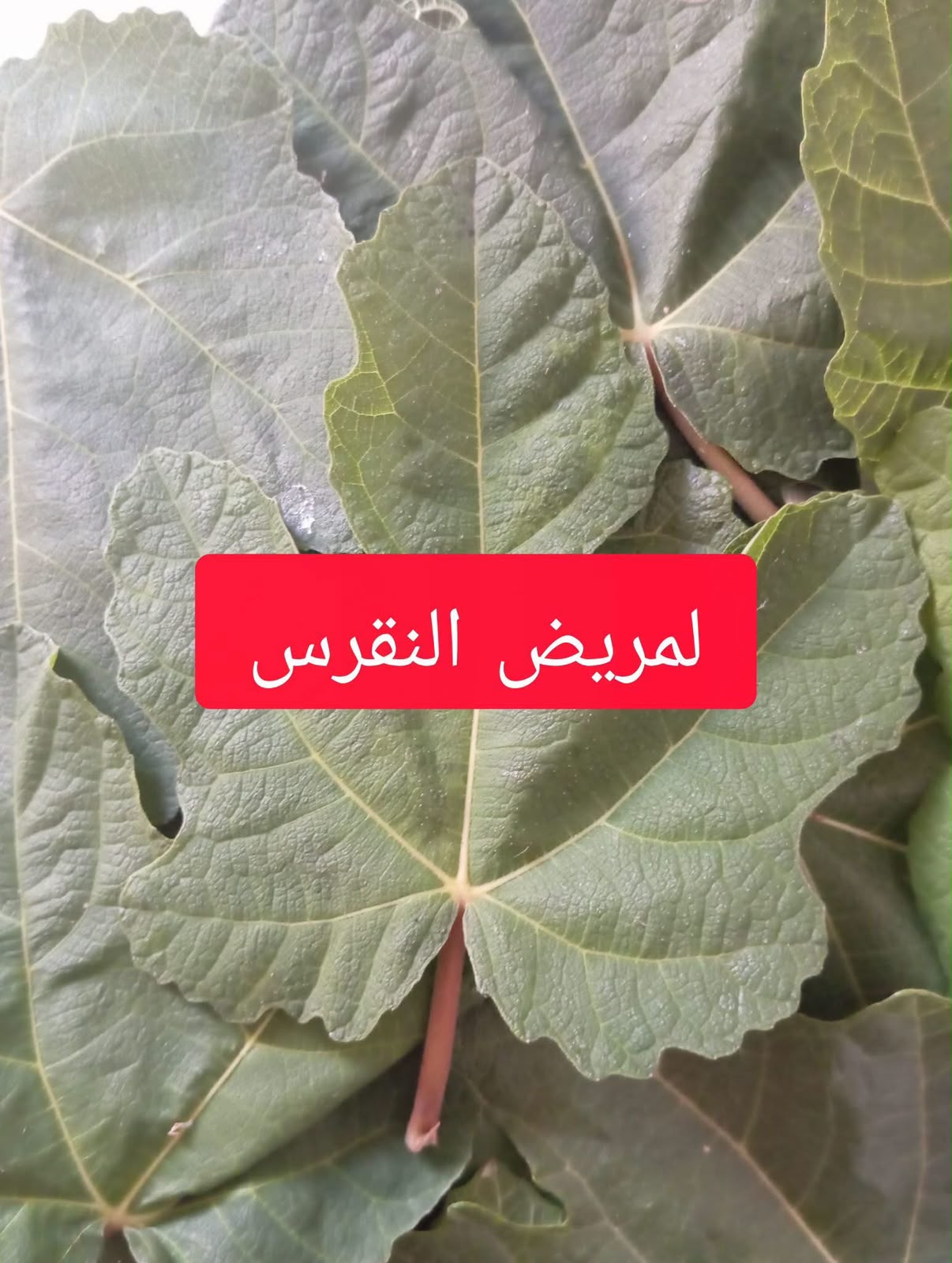 ورق التين والنقرس